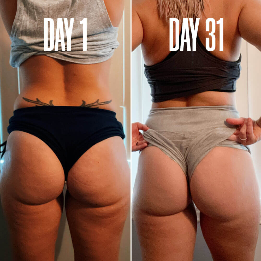The Cellulite Duo package